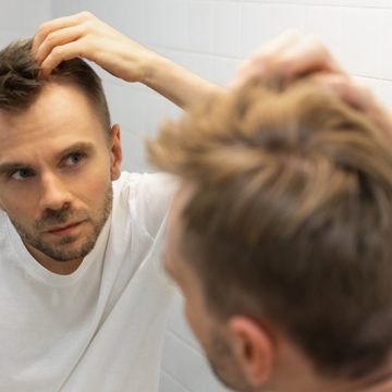 Hair Transplant Services with Eldi Health and Beauty: End to Hair Loss