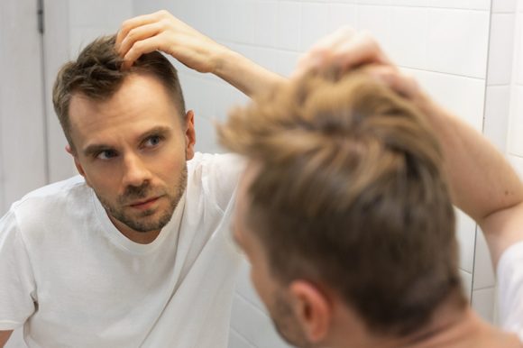 Hair Transplant Services with Eldi Health and Beauty: End to Hair Loss