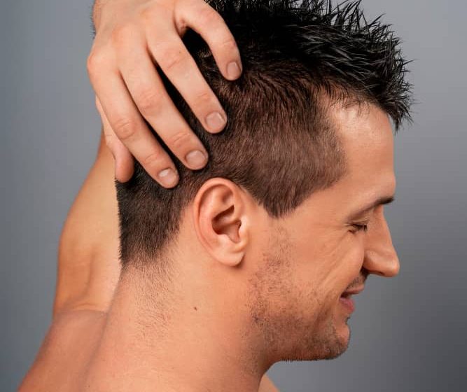 Essential Considerations for Hair Transplant Procedures